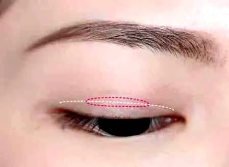 蕾丝双眼皮贴使用方法 防直男癌撕双眼皮的隐形神器