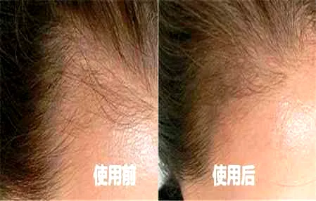 发际线粉能用眉粉代替吗_眉粉可以当发际线粉吗