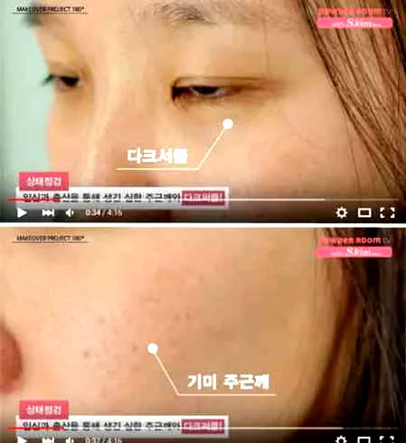 超遮瑕化妆步骤如下 超级强大的完美遮瑕技巧