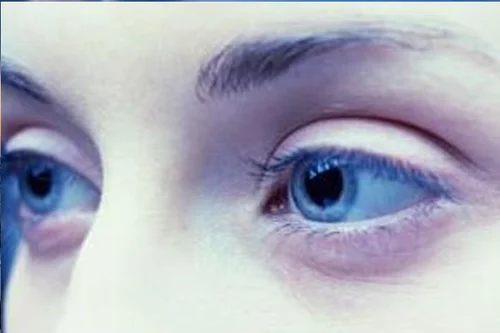 9.webp