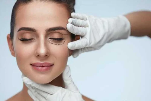 割双眼皮后的注意事项有哪些