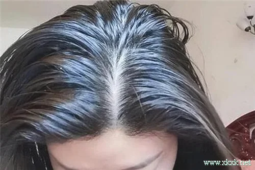 头发出油的原因以及调理方法