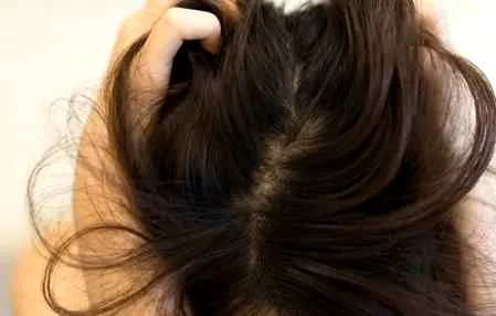 洗完头头发炸了怎么办 为什么洗完头会头发炸