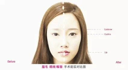 伊美尔新年推荐：这些整形项目让你美美过新年~