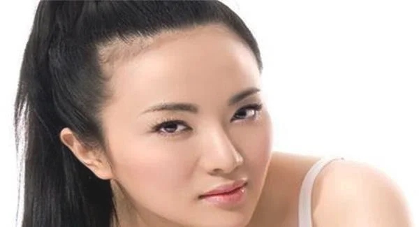 做额颞部除皱去鱼尾纹的流程是什么？恢复时间要多久？