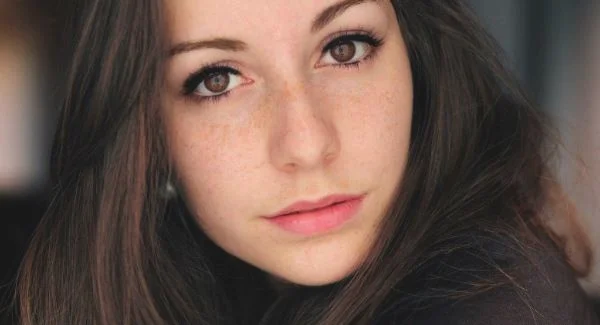 做激光去黄褐斑需要多少钱?费用是多少?