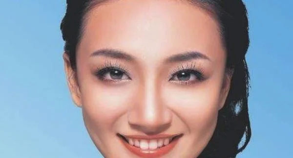 做光子治疗太田痣需要多少钱？费用是多少？