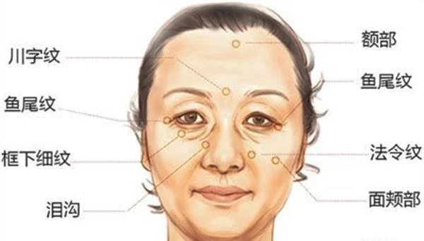 做悬吊除皱去法令纹价格要多少