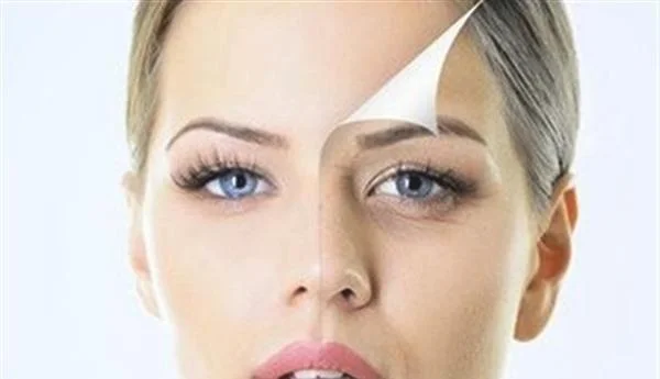 激光去法令纹效果怎么样?