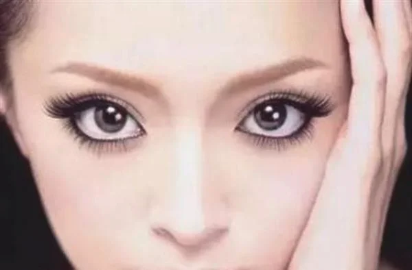 额颞部除皱去抬头纹不适合哪种人？