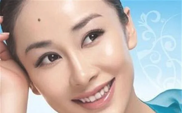 做微晶磨削去黑痣费用要多少