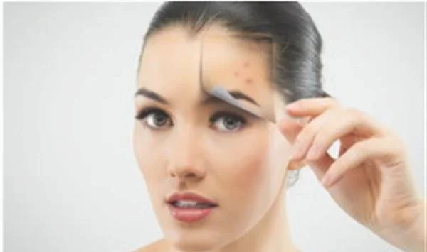 红蓝光祛痘手术注意事项是什么?