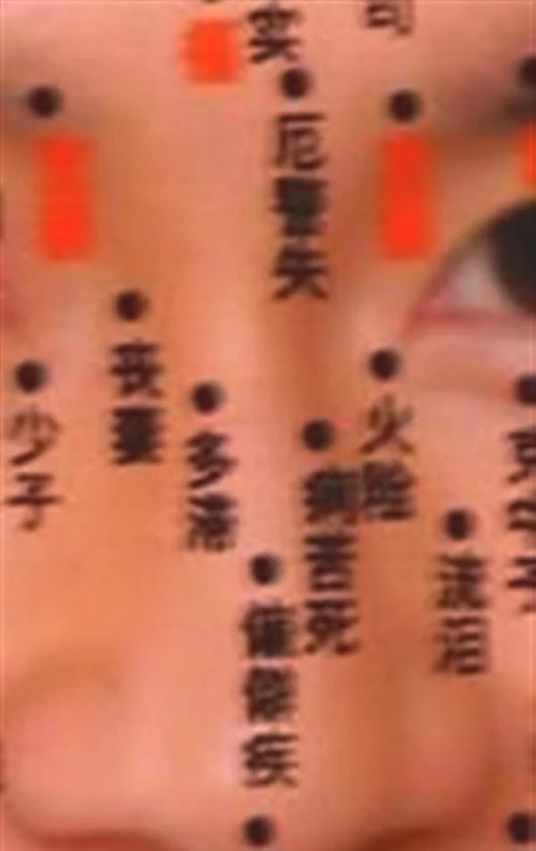 脸上长痣面相图