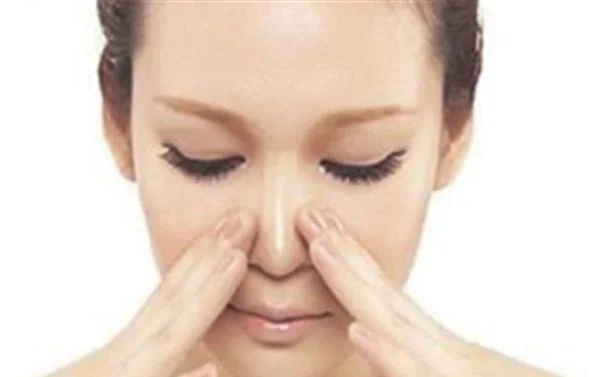 悬吊除皱去法令纹适合哪种人？