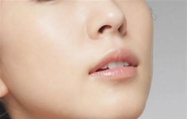 悬吊除皱去法令纹效果怎么样？