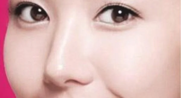 做E光美白价格是多少