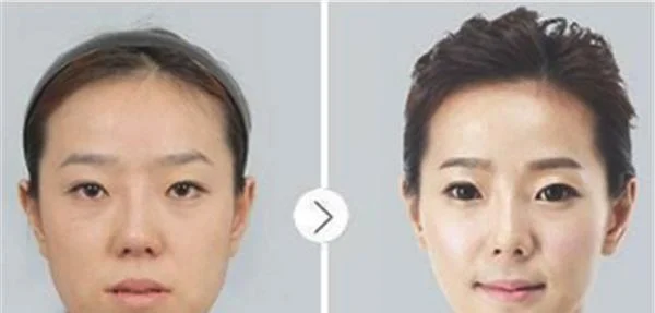 做黑脸娃娃美白价格多少钱