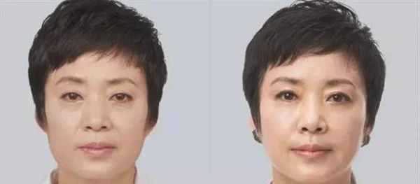 做热提拉多少钱