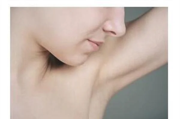 做冷冻去狐臭手术多少钱？