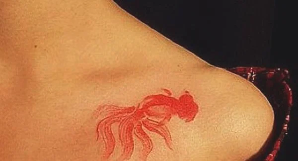 做电灼去纹身手术注意事项是什么?