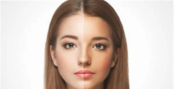 E光美白适合什么人？