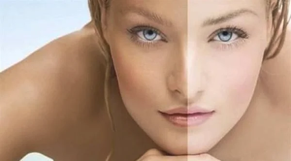 做皮肤美白价格要多少