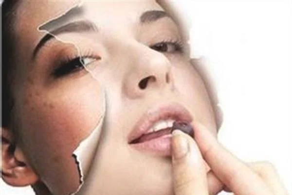 做化学剥脱祛斑价格贵不贵