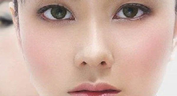 做去红血丝失败修复手术注意事项是什么？