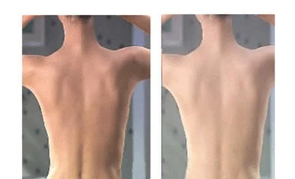 光子美白适合什么人？