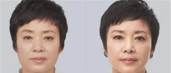做热提拉价格多少钱