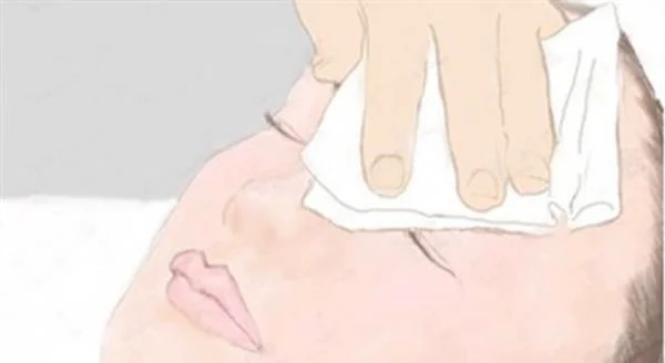 化学剥脱祛斑手术术后护理?