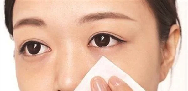 做去粉刺手术多少钱？