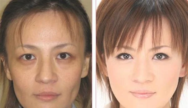做RV极速美塑美肤多少钱