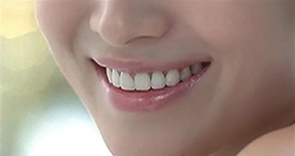 怎样有效的去黑头？