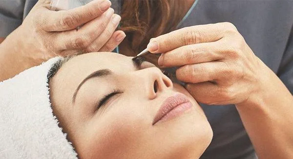 激光祛色斑多少钱