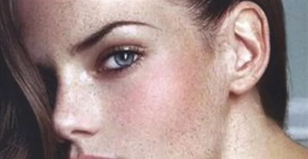 C8祛斑效果会不会反弹