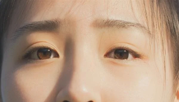 红蓝光祛痘价格