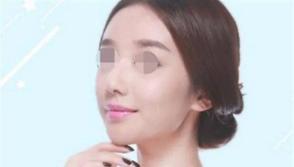 苏州埋线提升哪个医院做得好？