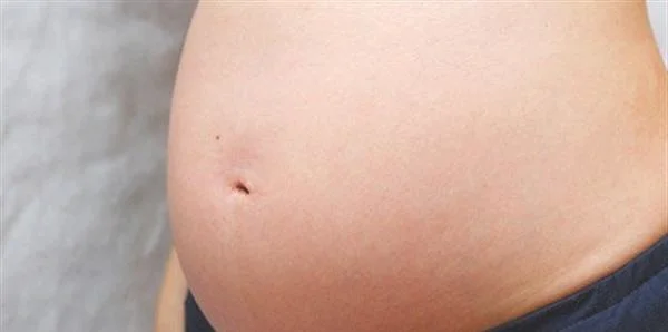 剖腹产疤该怎么办