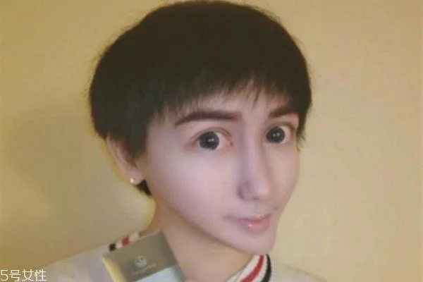 蛇精男刘梓晨 整容界奇葩 也是没谁了