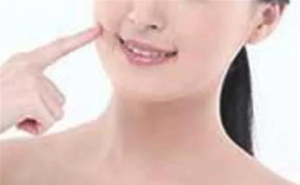 E光去痘印多少钱