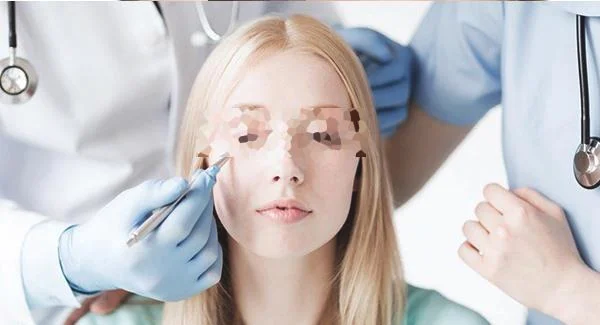 剥脱治疗太田痣多少钱