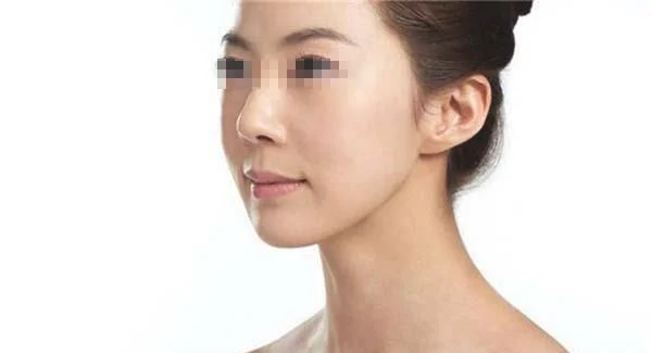 胶原蛋白去抬头纹价格