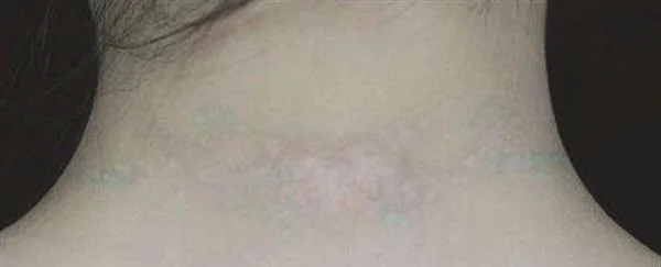 清洗纹身前后应注意的事项