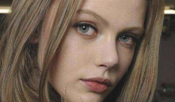 激光祛雀斑有用吗/激光祛斑可靠吗