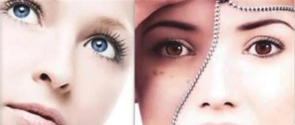 激光去痣手术多少钱