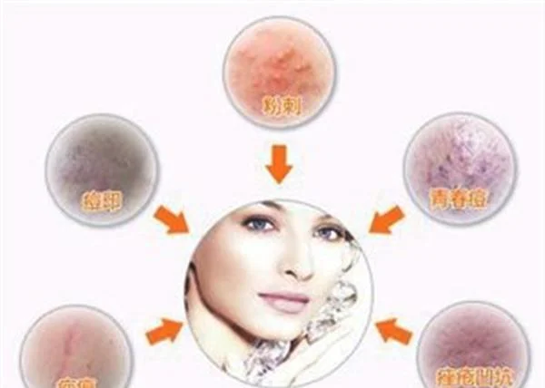 做像素激光的效果好不好