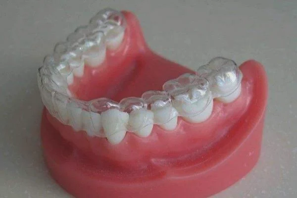 牙瓷贴片的效果怎么样