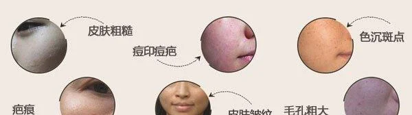 做像素激光费用是多少