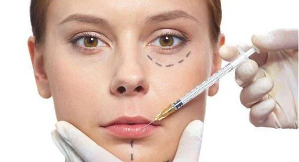 玻尿酸去眼角细纹好不好